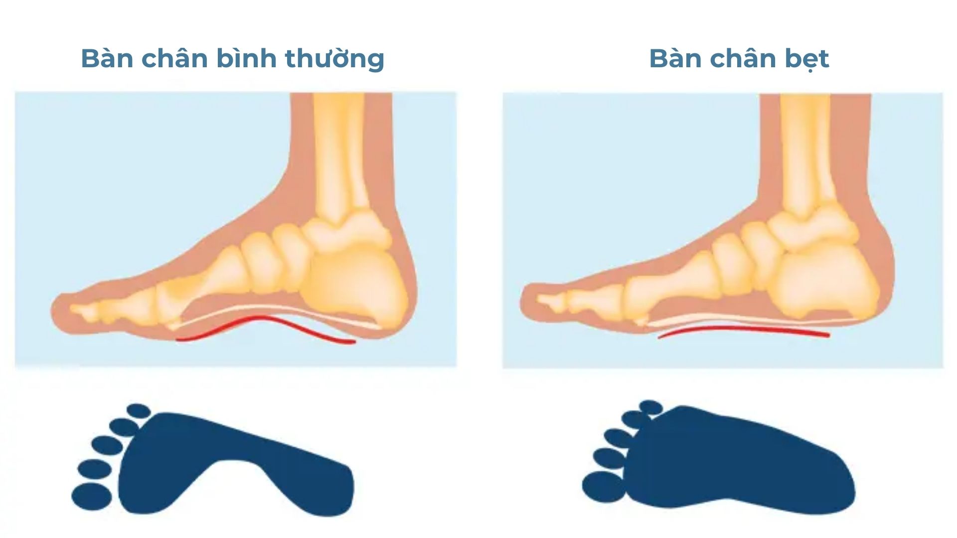 3 Bệnh Về Xương Khớp Thường Gặp ở Trẻ Cha Mẹ Cần Chú ý 